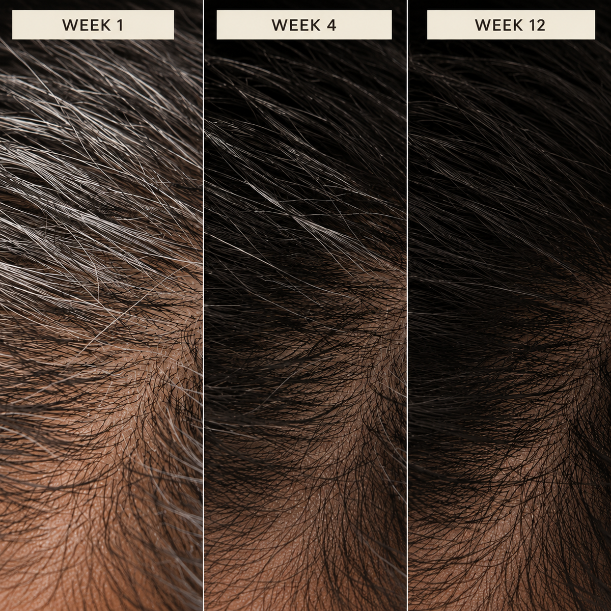 cubre canas progresivo